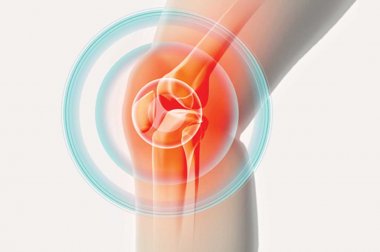 Illustration of pain radiating from knee