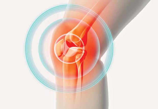 Illustration of pain radiating from knee